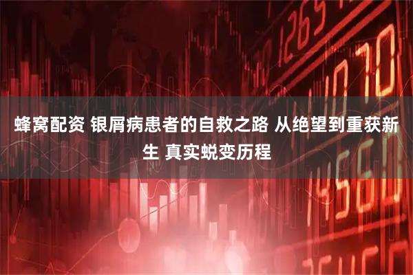 蜂窝配资 银屑病患者的自救之路 从绝望到重获新生 真实蜕变历程